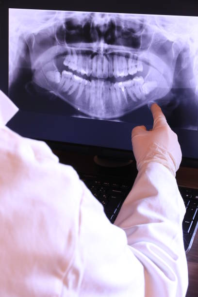 Best Emergency Wisdom Teeth Removal in Bushnell, FL